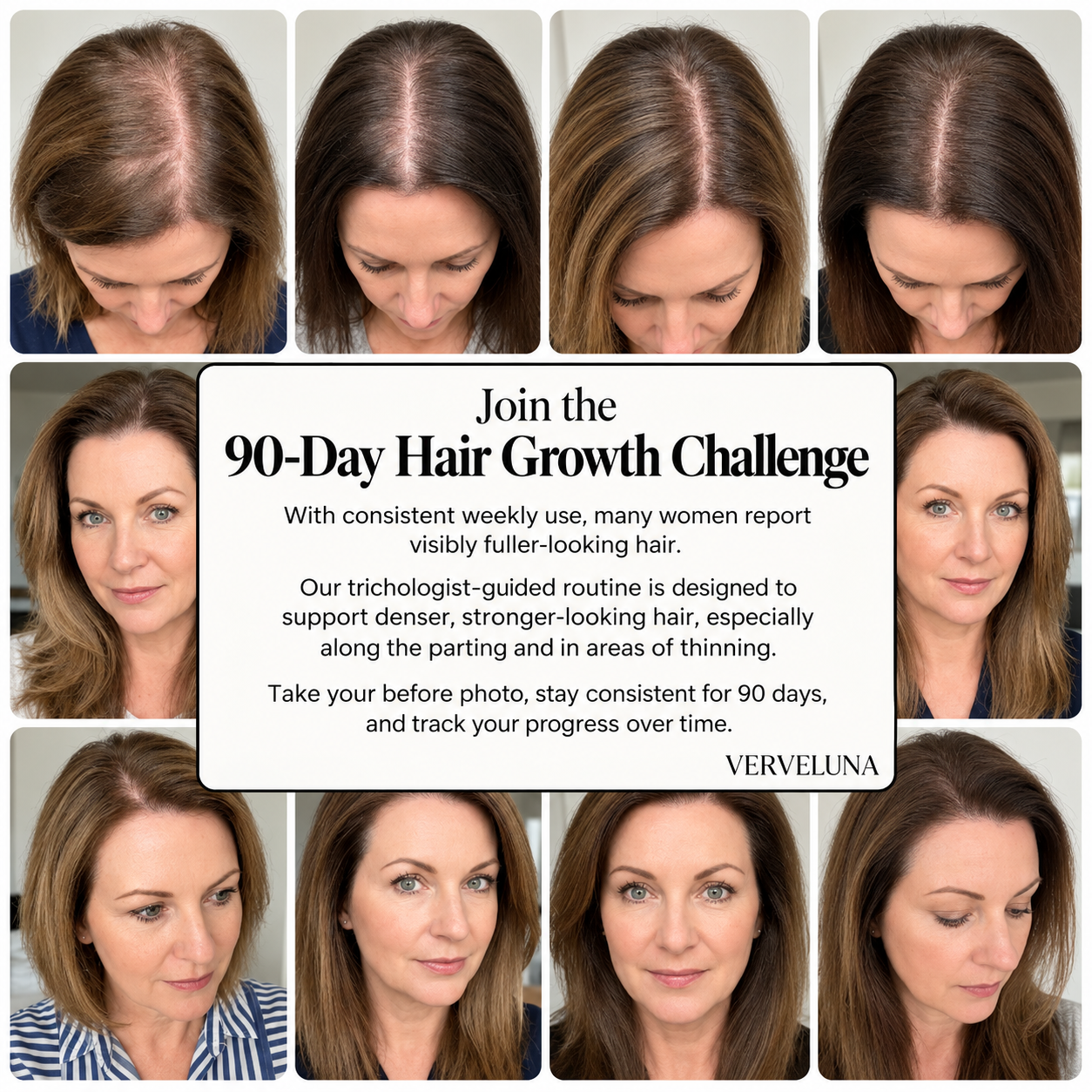 Verveluna™ Hair Regrowth System