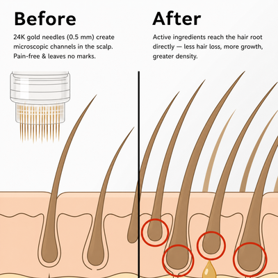 Verveluna ™ Hair Regrowth 2.0 Adenosine & Copper Peptide Micro-Infusion System