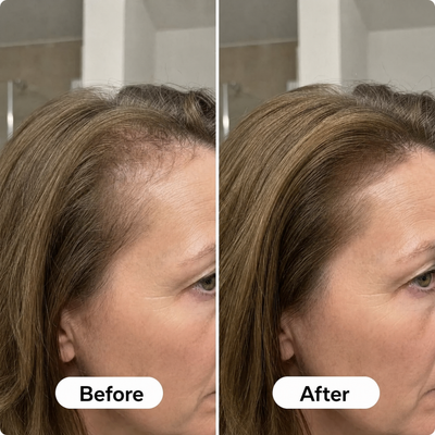 Verveluna ™ Hair Regrowth 2.0 Adenosine & Copper Peptide Micro-Infusion System