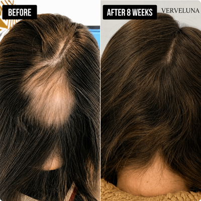 Verveluna ™ Hair Regrowth 2.0 Adenosine & Copper Peptide Micro-Infusion System