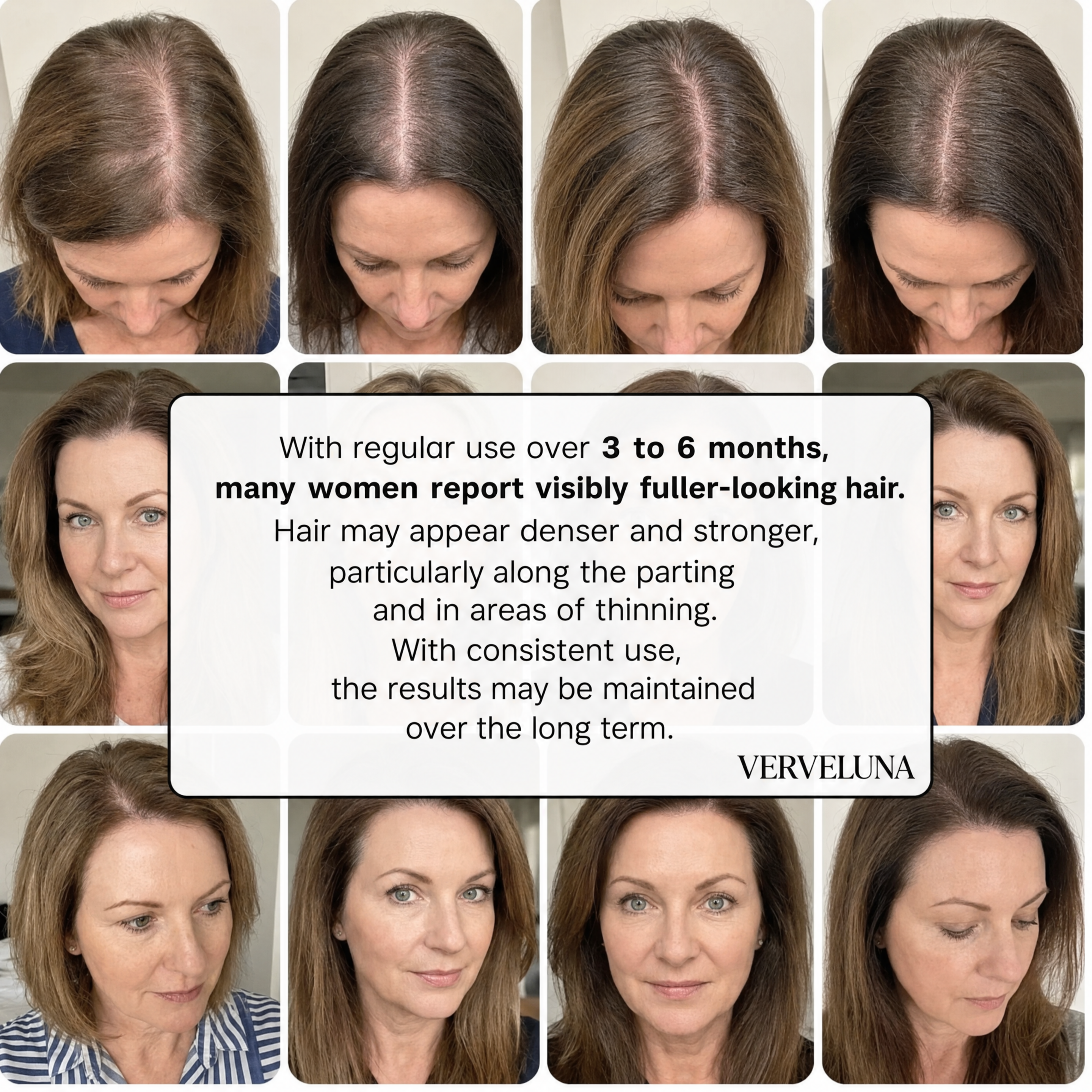 Verveluna ™ Hair Regrowth 2.0 Adenosine & Copper Peptide Micro-Infusion System