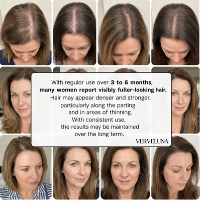 Verveluna ™ Hair Regrowth 2.0 Adenosine & Copper Peptide Micro-Infusion System