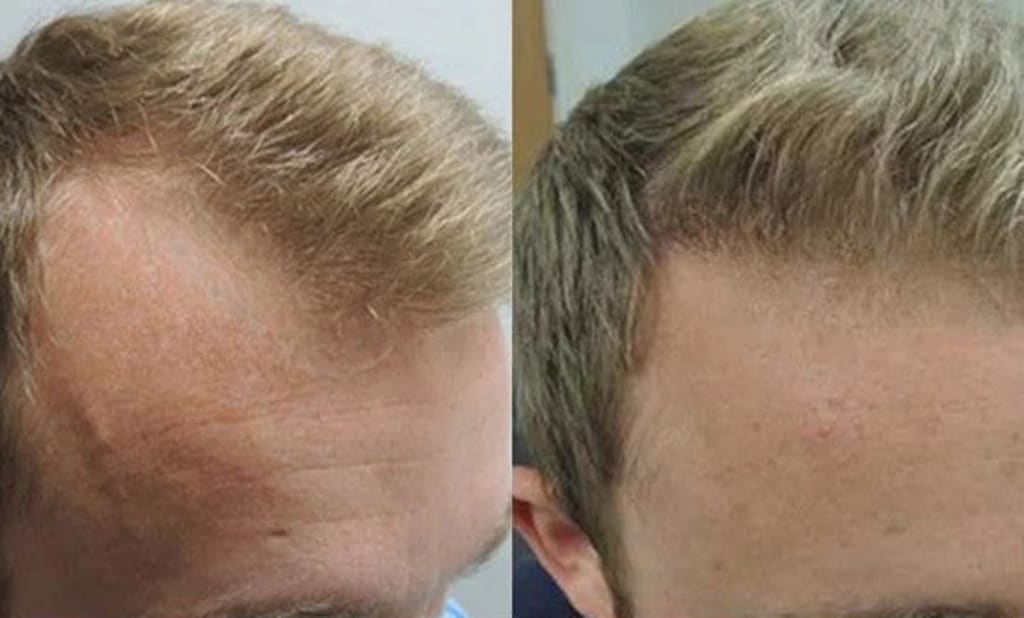 Hair Growth Roll-On Serum