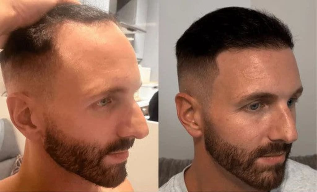 Hair Growth Roll-On Serum