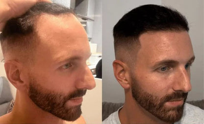 Hair Growth Roll-On Serum