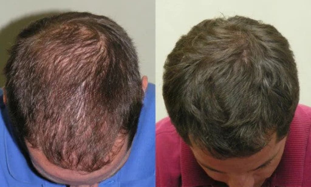 Hair Growth Roll-On Serum